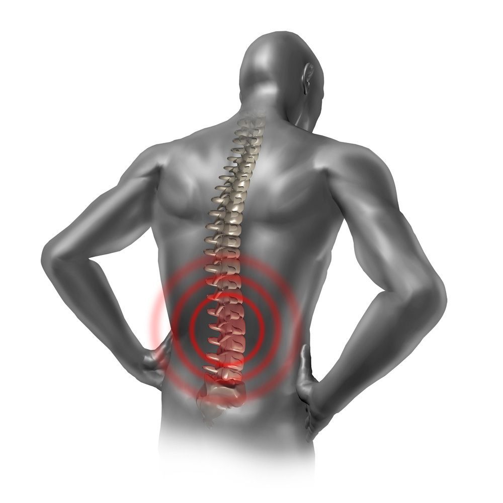 An illustrated example of a spinal cord injury 